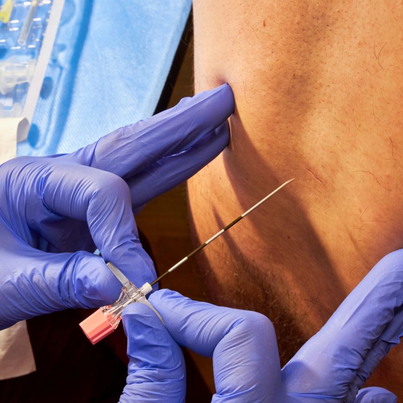 Anesthesia Services in Bareilly