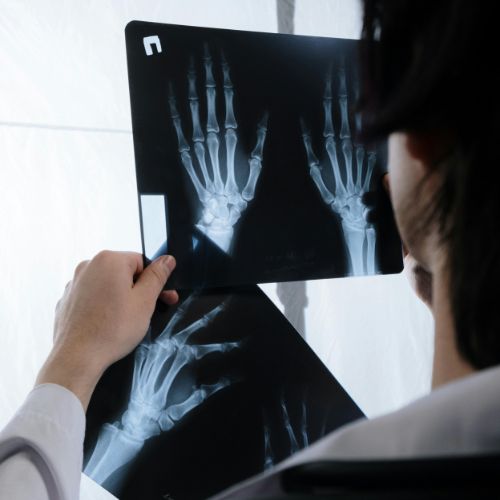 xray3